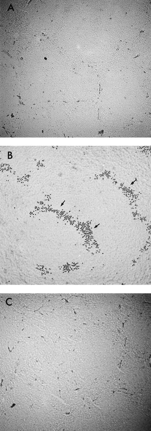 Fig. 2. Sialidase pretreatment of splenic cryostat sections enhances sialoadhesin-mediated adhesion of sheep erythrocytes. (A) Murine splenic cryostat section (untreated). (B) Murine splenic cryostat section pretreated with VC-sialidase; arrow denotes adherent sheep erythrocytes in the splenic marginal zones. (C) VC-sialidase treated splenic cryostat section pretreated with the antisialoadhesin blocking MoAb, 3D6.