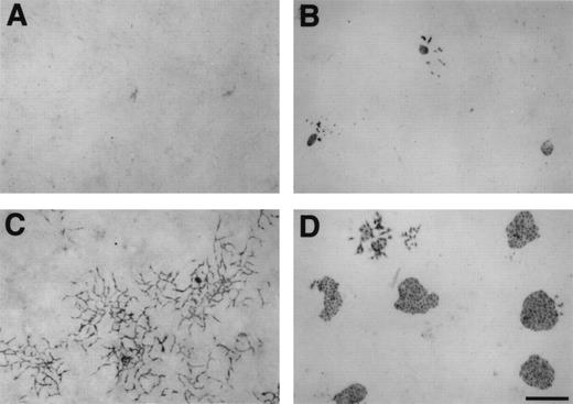 Fig. 3. Growth of Flk-1+ cell clusters supported by feeder layers. Sorted Flk-1+ cells were cultured at low cell density on a monolayer of each feeder cell line in the absence of exogenous factors. After 3 days of culture, immunostaining with MoAb for Flk-1 was performed as described in Materials and Methods. (A) NIH3T3 could not support their growth. (B) PA6 supported it poorly. (C and D) Notably, Flk-1+ cells grew to form the cord-like structure on Balb/c3T3 feeder layer (C), whereas they grew to form the sheet-like structure on OP9 feeder layer (D). Scale bar = 500 μm.