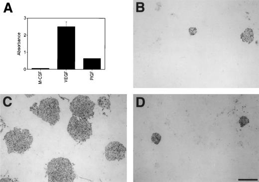 Fig. 5. Blocking effect of mFlt-1-hIgG1 on the growth of Flk-1+ cells on OP9 feeder layer. (A) The preparation of mFlt-1-hIgG1 and assessment of its binding to M-CSF, VEGF, or PlGF were performed as described in Materials and Methods. The bars show the mean (±SD) of triplicate samples. (B, C, and D) Sorted Flk-1+ cells were cultured on OP9 feeder layer in the presence of 100 ng/mL mFlt-1-hIgG1 (B), 100 ng/mL mFlt-1-hIgG1 and 3 ng/mL VEGF (C), or 100 ng/mL mFlt-1-hIgG1 and 100 ng/mL PlGF (D). After 3 days of culture, immunostaining with MoAb for Flk-1 was performed as described in Materials and Methods. Scale bar = 500 μm.