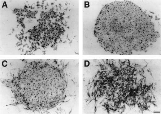 Fig. 7. VE-cadherin–mediated cell-cell adhesion of Flk-1+ cell clusters on OP9 feeder layer. (A) Sorted Flk-1+ cells were cultured on OP9 feeder layer in the presence of blocking MoAb against VE-cadherin (VECD1). After 3 days of culture, immunostaining with MoAb for Flk-1 was performed as described in Materials and Methods. Cell-cell contact was disrupted by this treatment, whereas the proliferation of Flk-1+ cells was not affected. (B, C, and D) Sorted Flk-1+ cells were cultured on OP9 feeder layer. After 3 days, the cultures were left untreated (B) or added either with 50 ng/mL VEGF (C) or 50 ng/mL VEGF and VECD1 (D) and were further incubated for another 24 hours. Each Flk-1+ cell preserved cell-cell contact in culture with VEGF (C), whereas cell-cell contact of Flk-1+ cells was completely disrupted in the presence of VEGF and VECD1 (D). Scale bar = 100 μm.