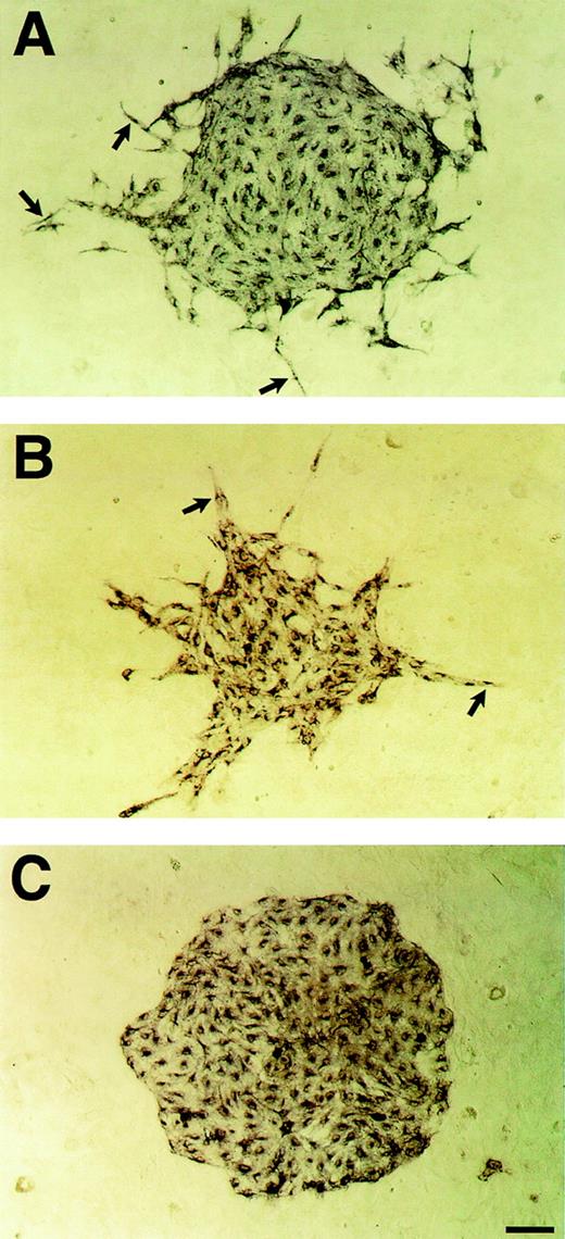 Fig. 6. VEGF-induced enhancement of the motility of Flk-1+ cells on OP9 feeder layer. Sorted Flk-1+ cells were cultured on OP9 feeder layer in the presence of VEGF or PlGF. After 3 days of culture, immunostaining with MoAb for Flk-1 was performed as described in Materials and Methods. Flk-1+ cells in the periphery of the sheets started to disperse at 3 ng/mL VEGF (A; arrows). At 50 ng/mL VEGF, Flk-1+ cells formed spiky clusters composed of spindle form cells (B; arrows). (C) In contrast to VEGF, 100 ng/mL PlGF had no effect on the motility of Flk-1+ cells. Scale bar = 100 μm.