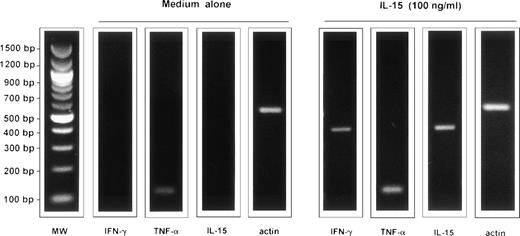 Fig. 2. RT-PCR analysis of the expression of the messages for IL-15, TNF-, and IFN-γ by AM of a representative healthy subject cultured for 24 hours in medium alone and in the presence of IL-15. The figure shows a representative healthy subject (subject #2) but a consistent pattern of expression was observed in five consecutively examined normal subjects. 96% of BAL cells of subject #2 were alveolar macrophages and 4% lymphocytes, as determined by morphological evaluation and the CD4/CD8 ratio was 2.1. AM were enriched as reported in the Materials and Methods section.
