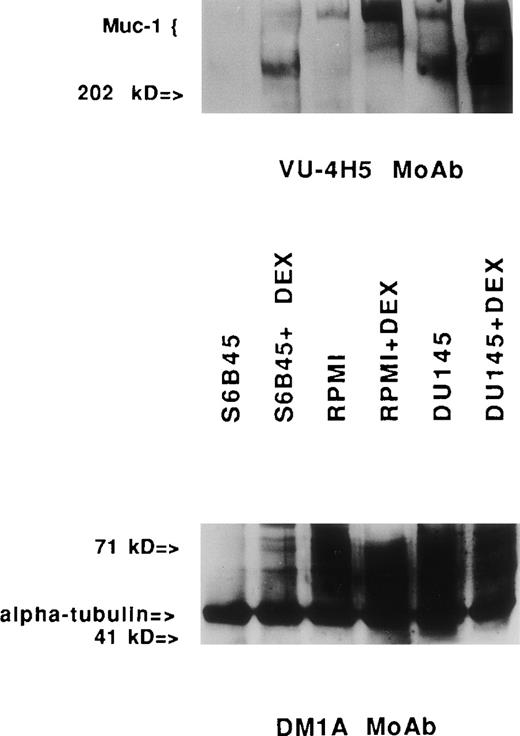 Fig. 6. Immunoblotting assays for Muc-1 expression in human MM and prostate cancer cell lines stimulated with Dex. Cell lysates obtained from human MM (S6B45 and RPMI 8226) and prostate cancer (DU145) cells cultured with media alone or with Dex (10−8mol/L) for 24 hours were examined by Western blot analysis using the VU-4H5 MoAb. Dual bands seen in the lysates from S6B45 and DU145 cells show coallelic expression of Muc-1.1 The DMA1 MoAb to -tubulin was used as a control antibody.
