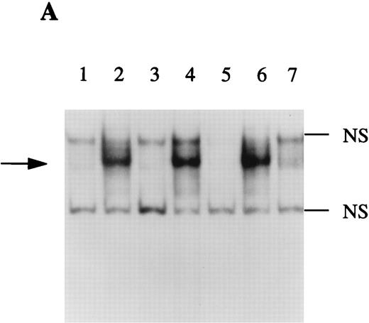 Fig. 7. EMSA of NF-κB binding activity. The DNA binding activity of nuclear extracts from HepG2 cells cultured in the presence or absence of IL-1β and/or IL-4 for 30 minutes were examined using a 32P-labeled oligonucleotide from the sIL-1Ra promoter containing the NF-κB binding site (A). Competition studies were performed with nuclear extracts from HepG2 cells stimulated with IL-1β (see Materials and Methods). Lane 1, unstimulated; lane 2, IL-1β; lane 3, IL-4; lane 4, IL-1β and IL-4; lane 5, competition with the cold probe; lane 6, competition with the cold probe mutated in the NF-κB binding site; lane 7, competition with the cold oligonucleotide containing the NF-κB consensus region. Characterization of the protein present in the NF-κB–DNA complex was performed using specific antibodies against p65(RelA) and p50 (B). Lane 1, unstimulated; lane 2, IL-1β; lane 3, preincubation of nuclear extracts of IL-1β–stimulated HepG2 cells with antibodies against NF-κB p65 (RelA) before the addition of the 32P-labeled NF-κB probe; lane 4, preincubation with antibodies against p50; lane 5, preincubation with control IgG; lanes 6 to 8 contain the NF-κB probe and the antibodies against the p65 subunit, p50 subunit, and control IgG, without nuclear extracts. The dark arrow shows the NF-κB–DNA complex. The open arrow represents the supershifted complex. NS = nonspecific protein-DNA binding. These results are representative of three different experiments.