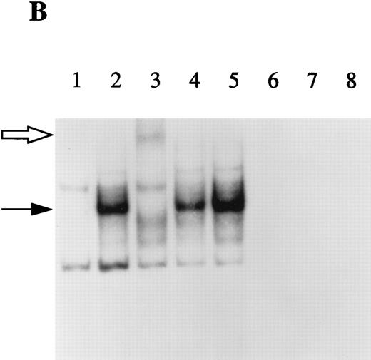 Fig. 7. EMSA of NF-κB binding activity. The DNA binding activity of nuclear extracts from HepG2 cells cultured in the presence or absence of IL-1β and/or IL-4 for 30 minutes were examined using a 32P-labeled oligonucleotide from the sIL-1Ra promoter containing the NF-κB binding site (A). Competition studies were performed with nuclear extracts from HepG2 cells stimulated with IL-1β (see Materials and Methods). Lane 1, unstimulated; lane 2, IL-1β; lane 3, IL-4; lane 4, IL-1β and IL-4; lane 5, competition with the cold probe; lane 6, competition with the cold probe mutated in the NF-κB binding site; lane 7, competition with the cold oligonucleotide containing the NF-κB consensus region. Characterization of the protein present in the NF-κB–DNA complex was performed using specific antibodies against p65(RelA) and p50 (B). Lane 1, unstimulated; lane 2, IL-1β; lane 3, preincubation of nuclear extracts of IL-1β–stimulated HepG2 cells with antibodies against NF-κB p65 (RelA) before the addition of the 32P-labeled NF-κB probe; lane 4, preincubation with antibodies against p50; lane 5, preincubation with control IgG; lanes 6 to 8 contain the NF-κB probe and the antibodies against the p65 subunit, p50 subunit, and control IgG, without nuclear extracts. The dark arrow shows the NF-κB–DNA complex. The open arrow represents the supershifted complex. NS = nonspecific protein-DNA binding. These results are representative of three different experiments.