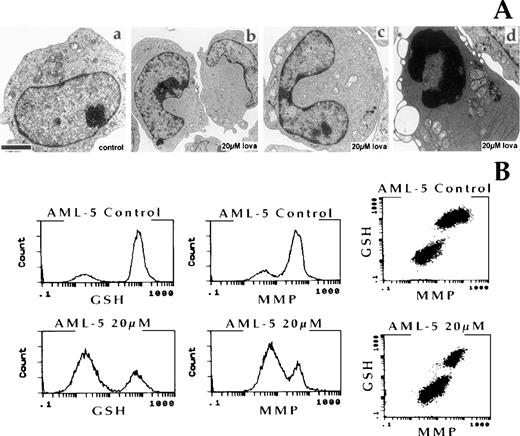 Fig. 4. (A) Ultrastructural features of the AML-5 cell line after 2 days of exposure to solvent control or 20 μmol/L lovastatin. (a) Control AML-5 cells; (b and c) lovastatin treatment-induced nuclear morphology changes in AML-5; (d) characteristic features of apoptosis were observed in the majority of lovastatin-treated AML-5 cells. The bar represents 1 μm. (B) Multilaser flow cytometric analysis of reduced GSH and MMP. AML-5 cells were exposed to solvent control or 20 μmol/L lovastatin for 2 days and analyzed. Dual-parameter dot plots of GSH and MMP for each sample are also presented.