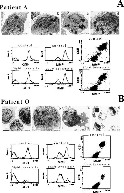 Fig. 7. Ultrastructural and biochemical features of AML leukemic blast cells after 2 days of exposure to solvent control or lovastatin. (A) A nonresponsive primary sample (patient A) and (B) a sensitive primary sample (patient O) were evaluated. (A) (a and b) Control blast cells; (c and d) 20 μmol/L lovastatin-treated blast cells from patient A displayed a number of large lysosomal granules. (B) (a and b) Control blast cells; (c) 20 μmol/L lovastatin-treated blast cells from patient O also displayed a number of large lysosomal granules in the few surviving cells; (d) 20 μmol/L lovastatin induced a prominent apoptotic response in patient O. The bar represents 1 μm except in (B) (b), where it represents 3 μm. Multilaser flow cytometric analysis of reduced GSH and MMP in the AML primary cultures A and O exposed to 20 μmol/L lovastatin for 2 days and analyzed. Dual-parameter dot plots of GSH and MMP for each sample are also presented.