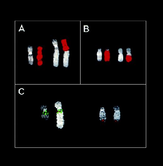 Fig. 4. FISH analysis of the U266 MM cell line. (A) Partial U266 metaphase hybridized with the chromosome 11 painting probe. (B) Partial U266 metaphase hybridized with the chromosome 14 painting probe. DAPI counterstaining is shown for each chromosome. (C) Partial U266 metaphase cohybridized with cosmid I4 (green), YAC 877-D-8 (green), and C1 (red) probes. For details concerning these probes, see text and Fig 1.