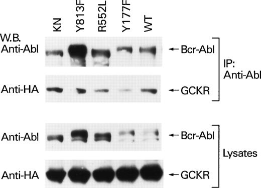 Fig. 4. P185 Bcr-Abl point mutants all associate with GCKR. p185 Bcr-Abl wild-type and mutant protein expression vectors (4 μg each) were transfected into HEK 293T cells (2 × 106) along with the HA-GCKR expression vector (2 μg). The association of Bcr-Abl point mutants with GCKR was examined by HA-immunoblotting anti-Abl immunoprecipitates. The presence of the p185 Bcr-Abl mutants in the immunoprecipitates was verified by immunoblotting with the immunoprecipitating antibody. The levels of expression of the Bcr-Abl mutants and HA-GCKR in the cell lysates are shown below. All the immunoblots were detected by ECL.