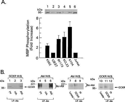 Fig. 6. GCKR is a downstream target of Bcr-Abl in Bcr-Abl+ cell lines. (A) Increased GCKR kinase activity in Bcr-Abl+ cell lines. GCKR immunoprecipitates from lysates prepared from 5 × 106 cells of the indicated cell line were subjected to an in vitro kinase assay. The data were normalized to the results with either U937 cells or Jurkat cells. The data shown summarize the results from four experiments and are presented as mean +/− 2 SD. Above the results of the in vitro kinase assay is an immunoblot showing the levels of GCKR in cell lysates prepared from the different cell lines. (B) Bcr-Abl and GCKR associate in K562 cells. Lysates prepared from 1 × 107K562 cells were immunoprecipitated with an antiphosphotyrosine MoAb (PY), a HA MoAb, the GCKR antiserum, preimmune (PI) antiserum, or an Abl polyclonal antiserum as indicated. The immunoprecipitates were subjected to immunoblotting with the indicated antibodies. The GCKR immunoblot (lanes 1 to 3) was stripped and reblotted for Abl (lanes 4 to 6). The Abl immunoblot (lanes 7 to 9) was stripped and reblotted for GCKR (lanes 10 to 12). Bcr-Abl and GCKR were detected in 50 μg of cell lysate (lanes 7 and 10, respectively). Molecular weight markers and the location of Bcr-Abl and GCKR are indicated.
