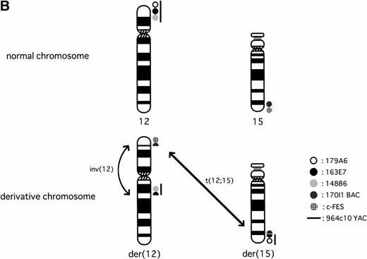 Fig. 1. (A) Physical map surrounding ETV6. The cosmid and YAC probes used in FISH analysis are shown underneath. (B) Schematic representation of t(12;15)(p13;q25) and inv(12)(p13q15) detected in the leukemic cells. Circles on the right indicate localization of probes detected in FISH analysis.