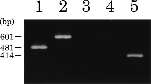 Fig. 5. RT-PCR analysis of ETV6-TRKC fusion products. Total RNA from t(12;15) leukemic cells (lanes 1 through 4) or NBTM cell line (lane 5) was reverse transcribed. PCR amplification was performed using primers ETV6-116f and ETV6-575r (lane 1),ETV6-116f and TRKC-1947r (lane 2), TRKC-1556f and ETV6-575r (lane 3), and TRKC-1556f andTRKC-1947r (lanes 4 and 5), respectively.