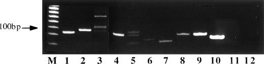 Fig. 3. Gel of VDJ-Ig-PCR amplimers of lymphoma tissues from SIV-infected monkeys. Lanes 3 and 5 correspond to oligoclonally rearranged lymphomas. Lanes 1, 2, 4, 6, 7, 8, and 9 show monoclonal rearrangements as well as lane 10 that contains DNA from the sARL-derived cell line SL-C18. Lanes 11 and 12 are DNA from tissue controls. Lane 11 corresponds to a tumor-free lymph node from one of the animals that developed lymphoma and lane 12 to a nonlymphoid tissue (kidney) from the same animal. The variable intensity of the bands displayed in this gel appears to be related to a variable amount of nontumor cells in each lymphoma case.