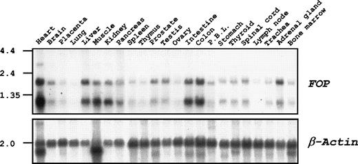 Fig. 3. FOP expression. Clontech Northern blots with the indicated poly(A)+ RNAs were hybridized with anFOP probe derived from cDNA insert of clone zs55g02. β-Actin was used as a control. The marker sizes (in kilobases) are indicated on the left.