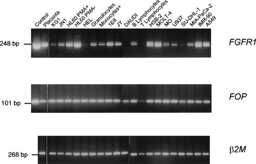 Fig. 4. Expression of FGFR1 and FOP genes. RT-PCR products were obtained from a variety of tissues and normal and tumoral hematopoietic cells using specific primer pairs of each gene. Each panel is a photograph of the ethidium bromide-stained agarose gel in which PCR products were electrophoresed. Labels at the top of rows indicate the source of the material. The first row corresponds to cDNA controls: a 2.5-kb FGFR1 cDNA (pFLG-16) containing the complete coding sequence (upper panel)49 and the FOP cDNA clone zs55g02 (middle panel), respectively. The other rows correspond to RNAs from a variety of lympho-hematopoietic cell lines (listed in Materials and Methods) and mature peripheral (T lymphocytes, B lymphocytes, and monocytes) blood cells purified as indicated in Materials and Methods. β2 microglobulin (β2M) amplification was used as a control.