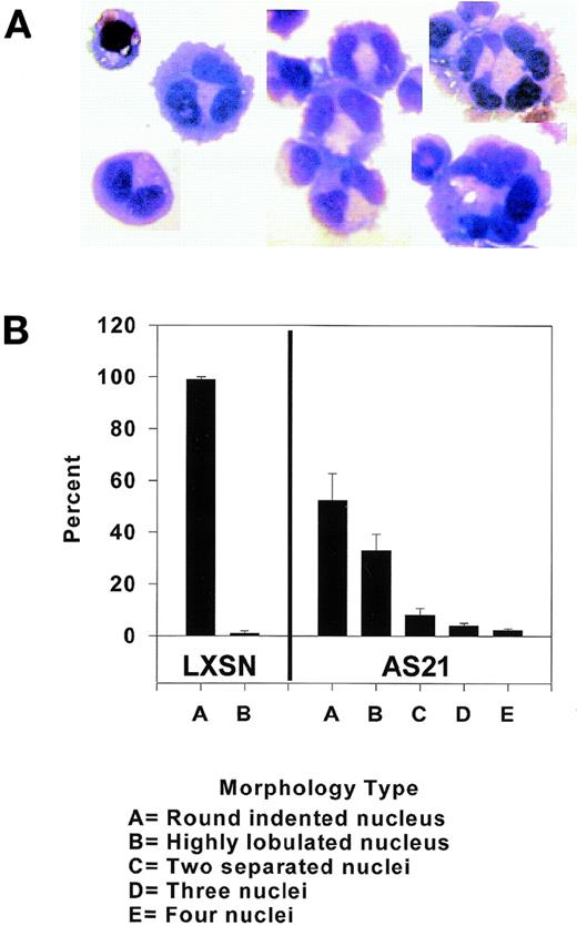 Fig. 2. Effect of antisense p21 mRNA expression on nuclear morphology. (A) Wright-Giemsa stain of a mononuclear LXSN cells (upper left). The others are examples of multilobular cells and/or cells with two, three, or more apparent nuclei from AS21 cultures. (B) Quantitation of different nuclear morphologies in transduced cells. Data from three separate cultures were pooled. Two hundred cells per culture were scored. Mean ± SD of each morphology is compared.