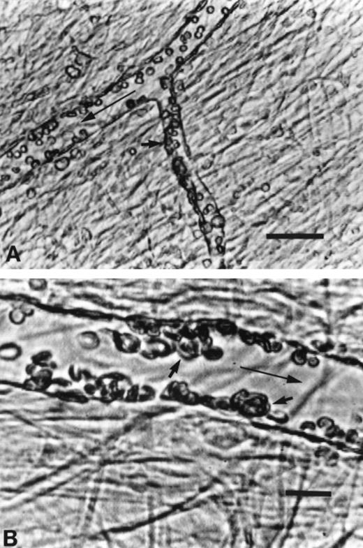 Fig. 6. Videomicrographs of TSP-enhanced adhesion of SS RBC in the ex vivo mesocecum venules. (A) Adhesion (small arrow) was confined to venules and (B) was characterized by frequent cluster formation of adherent SS RBC (small arrows) in the affected venules. The large arrow in each case indicates flow direction. Bar in A = 50 μm and bar in B = 20 μm.