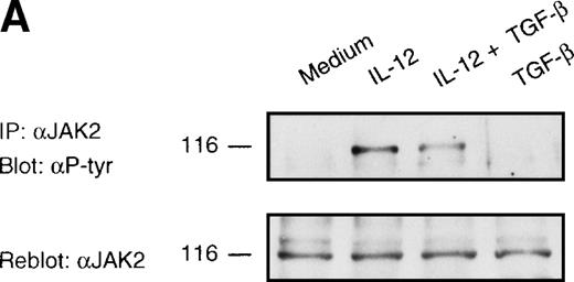 Fig. 3. Inhibition of IL-12–induced tyrosine phosphorylation of JAK2 and Tyk2 kinases by TGF-β. Western blot analysis of 6-day alloactivated T cells incubated in medium alone, IL-12 (5 U/106 cells), TGF-β (1 ng/106 cells), or IL-12 + TGF-β at 37°C for 20 minutes. The JAK2 (A) and Tyk2 (B) immunoprecipitates were resolved on 7% SDS-PAGE, transferred to nitrocellulose membrane, and probed with anti-phosphotyrosine Ab 4G10 (upper panels). The blots were stripped and reprobed with anti-JAK2 or anti-Tyk2 Abs (lower panels). Similar results were obtained in five separate experiments.