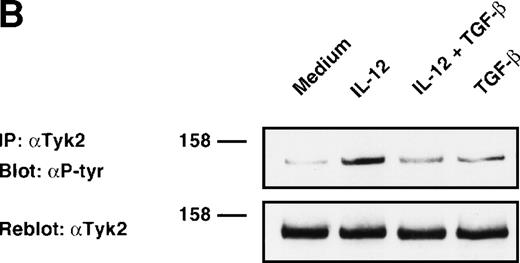 Fig. 3. Inhibition of IL-12–induced tyrosine phosphorylation of JAK2 and Tyk2 kinases by TGF-β. Western blot analysis of 6-day alloactivated T cells incubated in medium alone, IL-12 (5 U/106 cells), TGF-β (1 ng/106 cells), or IL-12 + TGF-β at 37°C for 20 minutes. The JAK2 (A) and Tyk2 (B) immunoprecipitates were resolved on 7% SDS-PAGE, transferred to nitrocellulose membrane, and probed with anti-phosphotyrosine Ab 4G10 (upper panels). The blots were stripped and reprobed with anti-JAK2 or anti-Tyk2 Abs (lower panels). Similar results were obtained in five separate experiments.