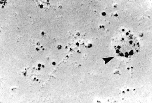Fig. 2. Localization of the oxidase to the neutrophil plasma membrane.34 Normal neutrophils were activated and unroofed, and the cytoplasmic face of the plasma membrane was labeled by the immunogold technique with anti-p67PHOX (large beads) and anti-gp91PHOX (small beads). The oxidase assemblies are gathered together in small clusters. Similar results were obtained with anti-p67PHOX/anti-p47PHOX and anti-p67PHOX/anti-Rac antibody pairs. (Reprinted with permission.34)