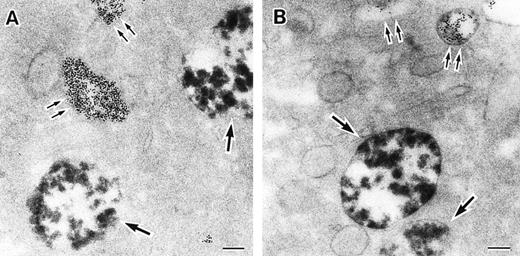 Fig. 3. Sites of O2− production in neutrophils as a function of time after activation.35 (Top) O2− production starts in secretory vesicles (clumped precipitate; single arrow). The membranes of these vesicles are distinct from the plasma membrane, because none of the O2−-forming vesicles contain the ferritin (punctate precipitate, double arrow) that was added to the extracellular medium during the incubation and then was internalized by pinocytosis. (Center) The O2−-forming secretory vesicles later fuse with pinocytotic vesicles to form secondary vesicles. The oxidase in the membranes of these secondary vesicles continue to deliver O2− into the vesicle lumina. (Bottom) O2−-forming secretory vesicles also fuse with the plasma membrane itself, leading to the secretion of O2− into the extracellular environment. (Reprinted with permission from Kobayashi T, Robinson JM, Seguchi H: Identification of intracellular sites of superoxide production in stimulated neutrophils. J Cell Sci 111:81, 1998, published by The Company of Biologists, Ltd, Cambridge, UK.35)