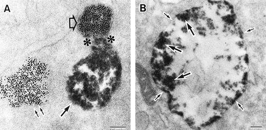 Fig. 3. Sites of O2− production in neutrophils as a function of time after activation.35 (Top) O2− production starts in secretory vesicles (clumped precipitate; single arrow). The membranes of these vesicles are distinct from the plasma membrane, because none of the O2−-forming vesicles contain the ferritin (punctate precipitate, double arrow) that was added to the extracellular medium during the incubation and then was internalized by pinocytosis. (Center) The O2−-forming secretory vesicles later fuse with pinocytotic vesicles to form secondary vesicles. The oxidase in the membranes of these secondary vesicles continue to deliver O2− into the vesicle lumina. (Bottom) O2−-forming secretory vesicles also fuse with the plasma membrane itself, leading to the secretion of O2− into the extracellular environment. (Reprinted with permission from Kobayashi T, Robinson JM, Seguchi H: Identification of intracellular sites of superoxide production in stimulated neutrophils. J Cell Sci 111:81, 1998, published by The Company of Biologists, Ltd, Cambridge, UK.35)