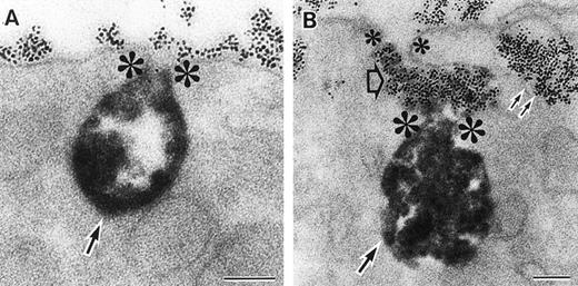 Fig. 3. Sites of O2− production in neutrophils as a function of time after activation.35 (Top) O2− production starts in secretory vesicles (clumped precipitate; single arrow). The membranes of these vesicles are distinct from the plasma membrane, because none of the O2−-forming vesicles contain the ferritin (punctate precipitate, double arrow) that was added to the extracellular medium during the incubation and then was internalized by pinocytosis. (Center) The O2−-forming secretory vesicles later fuse with pinocytotic vesicles to form secondary vesicles. The oxidase in the membranes of these secondary vesicles continue to deliver O2− into the vesicle lumina. (Bottom) O2−-forming secretory vesicles also fuse with the plasma membrane itself, leading to the secretion of O2− into the extracellular environment. (Reprinted with permission from Kobayashi T, Robinson JM, Seguchi H: Identification of intracellular sites of superoxide production in stimulated neutrophils. J Cell Sci 111:81, 1998, published by The Company of Biologists, Ltd, Cambridge, UK.35)