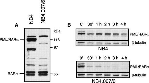 Fig. 1. PML/RAR expression in NB4.007/6 cells. (A) Western blot analysis of NB4 and NB4.007/6 whole-cell lysates using an anti-RAR antibody. The immunoreactive polypeptide that migrates above the indicated PML/RAR in both cell lysates is an anti-RAR cross reactive cellular protein. (B) In vitro degradation of PML/RAR in NB4 and NB4.007/6 cell lysates: NB4 cell lysate or NB4.007/6 + NB4 mixed cell lysates were incubated as indicated and 20 μg (NB4; top panel) or 40 μg (NB4.007/6 + NB4; bottom panel) of proteins were resolved by SDS-PAGE and analyzed by Western blotting using an anti-RAR antibody.