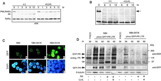 Fig. 2. Involvement of the proteasome in PML/RAR degradation. (A) NB4 cells were treated with 1 μmol/L RA in the presence (+LLnL) or in the absence (n.t.) of 50 μmol/L LLnL. The total lysates were resolved by SDS-PAGE and then analyzed by Western blotting using an anti-RAR antibody. The apparent degradation product of ∼97 kD is shown by the arrowhead. (B) NB4.007/6 cells were treated with 50 μmol/L LLnL (+LLnL) or left untreated (n.t.). Lysates were blotted with anti-RAR antibody. A polypeptide comigrating with PML/RAR appeared after 9 and 12 hours of LLnL incubation (black arrow). (C) NB4 and NB4.007/6 cells infected with retroviruses expressing GFP alone (pinco) or GFP-PML/RAR (pinco-GFP-PR LTR) and were then analyzed by fluorescence microscopy for GFP localization. After 36 hours from infection with the PINCO-GFP-P/R LTR, the NB4 and NB4.007/6 cell lines showed the typical nuclear microspeckled pattern of PML/RAR (panels a and c). Both cell lines showed a diffuse distribution of the GFP protein upon infection with the PINCO control retrovirus (only shown for the NB4.007/6 cells; panel e). Panels b, d, and f show the corresponding DAPI staining. (D) NB4 and NB4.007/6 cells were infected with the pinco or the pinco-GFP-PR LTR retroviral vectors and variably treated with RA or LLNL, as indicated. Corresponding lysates were resolved by SDS-PAGE and then analyzed by Western blotting using anti-RAR, anti-GFP, and anti-β–tubulin (to normalize for protein amounts loaded) antibodies, as indicated.