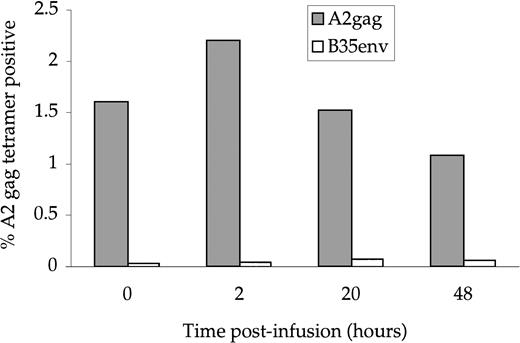 Fig. 2. Tetramer-specific A2 Gag cells before and after infusion. PBMC taken from the patient at the indicated timepoints were stained with anti–CD8-tricolor, A2 Gag-specific tetramer-PE and a control, B35 Env-specific tetramer-PE. The percentages shown represent CD8+/tetramer-positive cells.