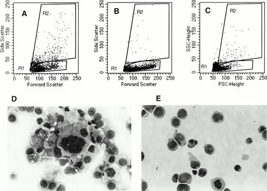 Fig. 7. Morphological characteristics of cells migrating in response to SDF-1. After migration, cultured cells were analyzed for their morphological characteristics. Dot plot analysis (FSC versus SSC) of starting population (A), cells migrated in response to SDF-1 (B), and cells migrated in absence of SDF-1 (C) are shown. May-Grunwald-Giemsa staining of the starting cell fraction (D) and the cell fraction that migrated in response to SDF-1 (E) are shown.