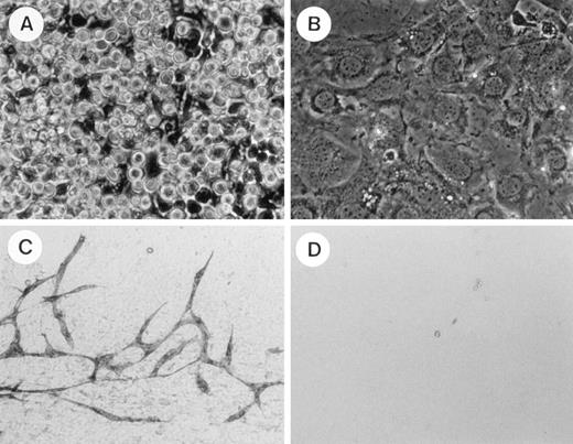 Fig. 5. Hematopoietic and endothelial cell development from TEK+ fraction of AGM cells at 10.5 dpc. Each number of TEK+ or TEK− cells (2,000) from AGM at 10.5 dpc was cocultured with OP9 cells. Hematopoietic cells were developed from the TEK+ fraction for 10 days of culture (A). These were not observed in the culture of the TEK− fraction (B). After cell suspensions were removed, the OP9 cell layer was immunostained with PECAM-1 MoAb. PECAM-1+ endothelial cells formed a network in the culture of the TEK+fraction (C). No PECAM-1+ cells were detected in the culture of the TEK− fraction (D).