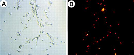 Fig. 6. Induction of endothelial cell growth by angiopoietin-1. Two thousand TEK+ cells from the AGM region were seeded onto OP9 cell layers in a 24-well plate. When angiopoietin-1 was added, cord-like strutures of endothelial cell growth were observed (A) and these cells show uptake of DiI-Ac-LDL (B).