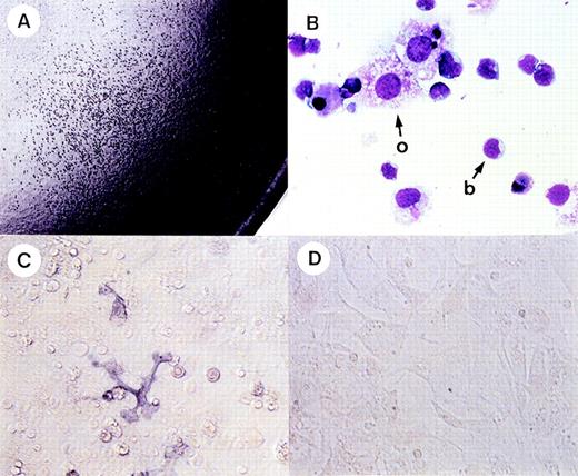 Fig. 8. Hematopoietic and endothelial cell development from single TEK+ cells. Single TEK+ cells from AGM at 10.5 dpc were seeded on OP9 in the presence of angiopoietin-1 and IL-3. (A) Hematopoietic cells developed on day 7 of culture in 96-well microtiter plates. (B) Hematopoietic blast cells (b) and OP9 cells (o) were revealed by cytospin preparation with Giemsa staining. These cells were adhered to the stromal layer. (C) PECAM-1+ endothelial cells were detected in the presence of angiopoietin-1 (100 ng/mL) and IL-3 (100 U/mL). (D) No PECAM-1+ cells were detected in the presence of IL-3 (100 U/mL) alone.