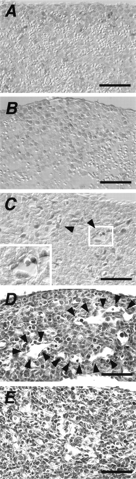 Fig. 3. Expression of Ad4BP/SF-1 in fetal and newborn spleens and structural changes observed in the early stages of splenic development. Immunohistochemical analysis was performed using splenic tissues from wild-type (A) and KO (B) newborn mice and spleen of an E 14.5 mouse fetus. Arrowheads in (C) indicate tubular structure composed of Ad4BP/SF-1 immunoreactive cells. Inset: higher magnification of the tubular structure. Spleens of E16.5 fetuses of wild-type (D) and KO (E) mice were histologically examined with hematoxylin and eosin. Arrowheads in D indicate longitudinal sections of the tubular structures. Scale bars: 100 μm.