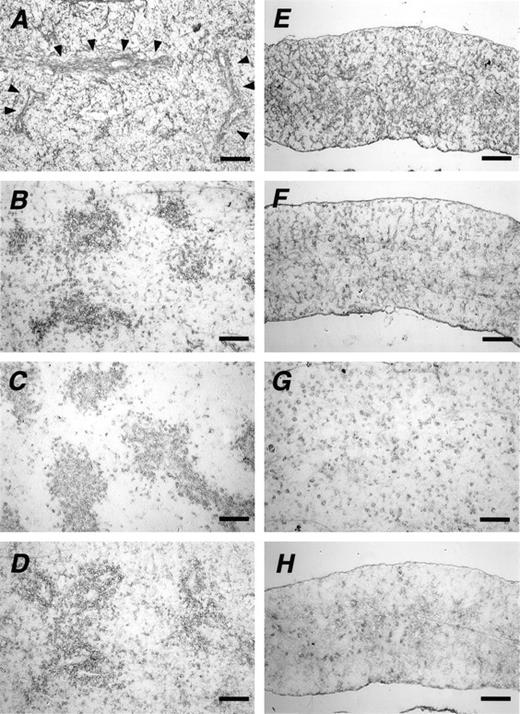 Fig. 4. Altered distribution of marker proteins. Frozen sections of spleens of newborn wild-type (A, B, C, and D) and KO mice (E, F, G, and H) stained with antibodies to type-IV collagen (A and E), laminin (B and F), c-kit (C and G), and vimentin (D and H). Arrowheads in (A) indicate a fibrous structure. Scale bars: 100 μm.