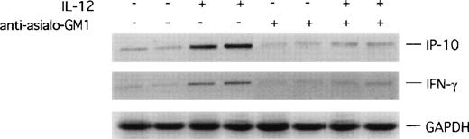 Fig. 5. RT-PCR analysis of IP-10 and IFN-γ expression in Matrigel plugs. mRNA was prepared from duplicate sets of Matrigel plugs impregnated with bFGF alone, bFGF + IL-12, bFGF + antiasialo GM1 antibody, or bFGF + IL-12 + antiasialo GM1 antibody, reverse-transcribed, and subjected to PCR amplification using specific primers for murine IP-10 and IFN-γ. The amplified products were electrophoresed through a 1.5% agarose gel.