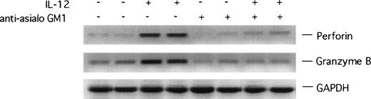 Fig. 7. RT-PCR analysis of murine perforin and granzyme B expression in Matrigel plugs. mRNA was prepared from Matrigel plugs impregnated with bFGF alone, bFGF + IL-12, bFGF + antiasialo GM1 antibody, or bFGF + IL-12 + antiasialo GM1 antibody, reverse-transcribed, and subjected to PCR amplification using specific primers for murine perforin and granzyme B. The amplified products were electrophoresed through a 1.5% agarose gel.