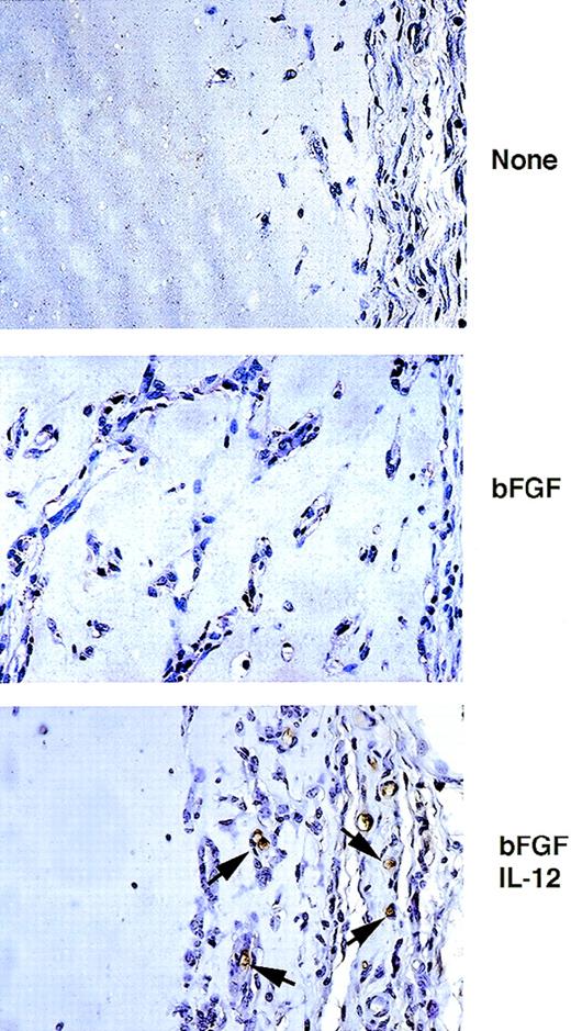 Fig. 1. Immunohistochemical analysis of asialo GM1-positive cells infiltrating and surrounding Matrigel plugs. Paraffin-embedded sections from Matrigel plugs alone or Matrigel plugs impregnated with bFGF, or bFGF + IL-12 were stained with a monoclonal antimouse asialo GM1 antibody, counterstained with hematoxylin, and examined by light microscopy. Original magnification ×40.