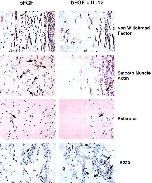 Fig. 2. Histochemical analysis of cells infiltrating Matrigel plugs. Paraffin-embedded sections from Matrigel plugs induced by either bFGF alone or in conjunction with IL-12 were stained with rabbit anti–von Willebrand factor, mouse anti–alpha smooth muscle actin monoclonal antibody, or rat antimouse B220 monoclonal antibody and counterstained with hematoxylin. Staining for esterase used conventional methods. Original magnification ×40.