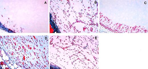 Fig. 4. Representative photomicrographs depicting the effects of antiasialo GM1 antibody on inhibition of bFGF-induced neovascularization by IL-12. Female BALB/c mice were injected subcutaneously with Matrigel alone (A), Matrigel impregnated with bFGF alone (B), bFGF + IL-12 (C), bFGF + antiasialo GM1 antibody (D), or bFGF + antiasialo GM1 antibody + IL-12 (E). Matrigel plugs were removed 7 days after injection and were processed for histology. The sections were stained with Masson’s trichrome. Original magnification ×20.