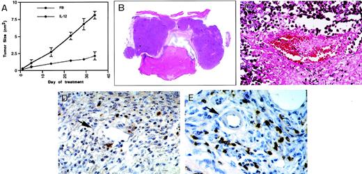 Fig. 8. Vascular effects and NK-cell recruitment in experimental Burkitt tumors treated locally with IL-12. (A) Effects of local diluent (FB) or IL-12 inoculation (200 ng/mouse/d, 7 d/wk) on the growth of Burkitt tumors established subcutaneously in nude mice. The results reflect mean (±SD) tumor sizes of 4 animals/group. (B) Gross morphology of a representative Burkitt tumor treated locally with IL-12 for 34 days (no magnification). (C) Microscopic morphology of a representative Burkitt tumor treated locally with IL-12 for 34 days depicting vascular pathology (original magnification ×40). (D, E) Immunohistochemical detection of NK cells by the B220 monoclonal antibody in representative Burkitt tumors treated locally with IL-12 depicting positive cell staining surrounding a capillary vessel with discontinuous endothelium (D, original magnification ×40), and positive cell staining surrounding a small arteriole (E, original magnification ×40).