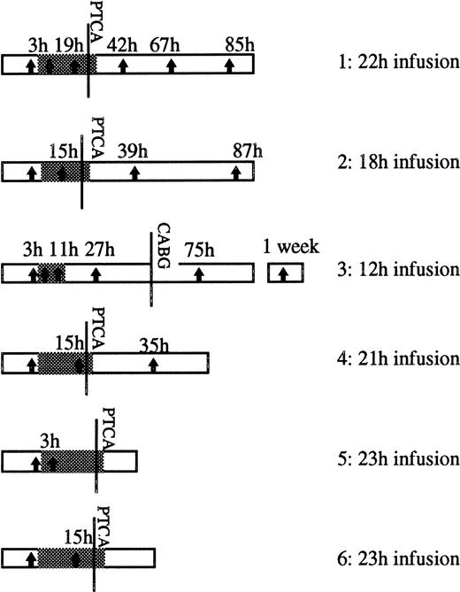 Fig. 1. Schema showing the duration of the abciximab infusion (grey section) following the bolus in each of the patients studied. The moment at which PTCA was performed is indicated, as is the time at which patient 3 underwent CABG. The vertical arrows show the times (h) at which samples were taken for EM and platelet function testing. The point at which abciximab therapy started is considered as time zero.