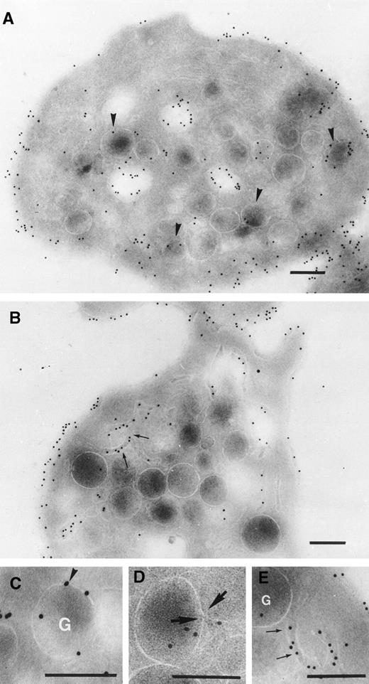 Fig. 3. Detection of abciximab by immunogold labeling using an affinity-purified rabbit antibody specific for c7E3. Examined were frozen ultrathin sections of platelets taken from patient 1 (A) 3 hours or 19 hours (B through E) into the infusion. High-power magnifications of a labeled -granule and of thin tortuous channels of the SCCS are shown in (C) and (E), respectively. In (D) a very thin aperture in the membrane of -granule at a point of junction of a thin channel is shown and indicated between two arrows. Bars = 0.2 μm.