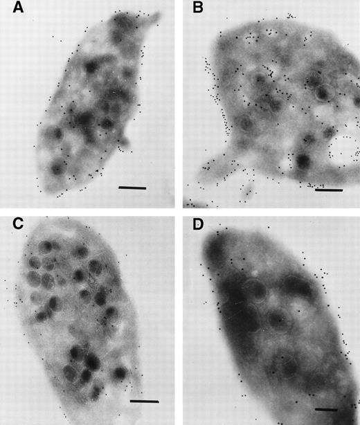 Fig. 4. Immunogold labeling for abciximab on ultrathin sections of platelets taken (A) 20 hours after the end of the abciximab infusion (patient 1), (B) 15 hours after the end of the infusion (patient 3), (C) 67 hours after the end of the infusion (patient 1), (D) 1 week after the end of the infusion (patient 3). There is a notable decrease in the labeling at the longer time points. Bars = 0.2 μm.