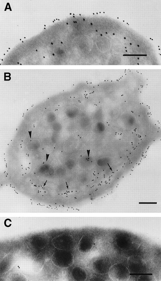 Fig. 5. Incubation of platelets from a control donor (A and B) and a patient with Glanzmann’s thrombasthenia (C) with abciximab in vitro. Platelets were fixed after 1-minute (A) or 1-hour staining (B and C). Arrows highlight the presence of gold particles within the thin channels of the SCCS, arrow heads indicate gold particles associated with -granules. In (C) almost no labeling was seen. Bars = 0.2 μm.