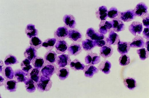 Fig. 2. Purified eosinophils isolated by flow cytometric sorting. Photomicrograph showing eosinophils purified from peripheral blood by flow cytometric sorting to greater than 90% purity. (Giemsa, × 1,300 original magnification).