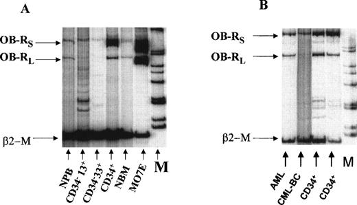 Fig. 2. (A) Expression of OB-R in normal bone marrow (NBM), normal peripheral blood (NPB) and sorted myeloid progenitors (CD34+, CD34−33+, CD34−13+) from adult bone marrow. The MO7E cell line served as a positive control. (B) OB-Rexpression in FACS-sorted CD34+ cells from normal bone marrow, AML, and chronic myeloid leukemia in blast crisis (CML-BC). β2-M, β2-microglobulin; OB-Rl, long isoform (501 bp); OB-Rs, short isoform (720 bp); M, molecular-weight marker.