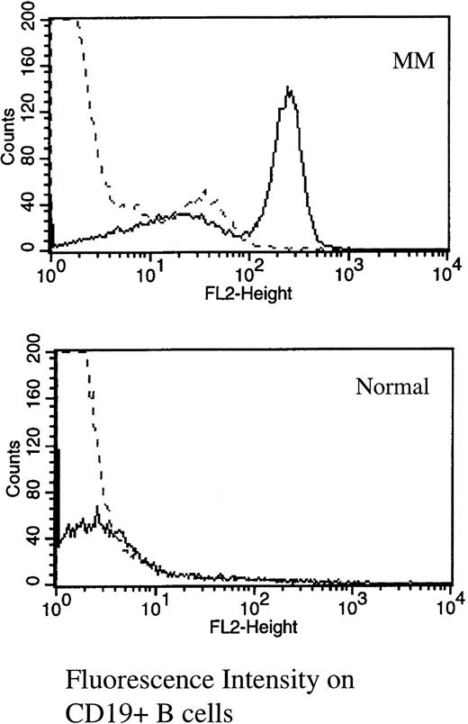 Fig. 1. RHAMM is expressed on the majority of MM blood B cells, but is absent from most normal B cells. PBMC from MM or normal donors were stained with B4-FITC (CD19) and RHAMM or an isotype-matched IgG1 control (indirect immunofluorescence with a second-stage goat antimouse Ig-PE). Files were gated for B cells and the expression of RHAMM plotted as a histogram. (—) RHAMM staining; (—-) isotype control staining.