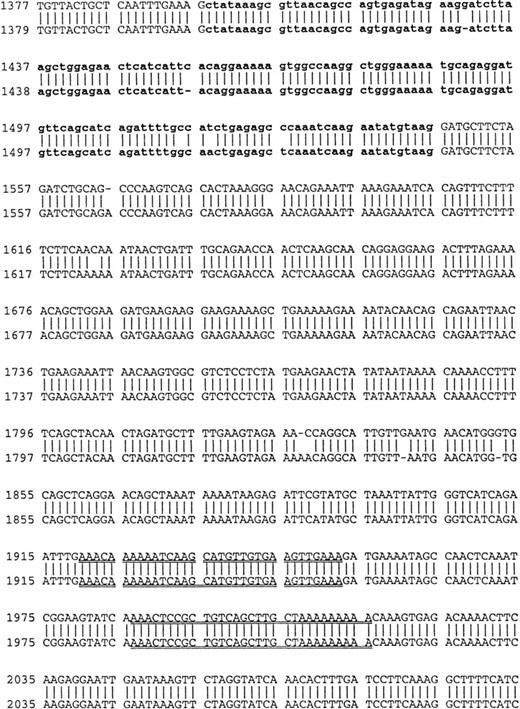 Fig. 3. Comparison of B-cell and plasma cell RHAMM. RHAMM cDNA fragments were amplified from MM B cells and BM plasma cells by RT-PCR with RHAMM-specific primers and subsequently cloned and sequenced. The nucleotide sequences of the RHAMM fragments were aligned to generate the sequence of B-cell RHAMMFL and BM plasma cell RHAMMFL. The 48-bp deletion and the 147-bp deletion that characterize RHAMM−48 and RHAMM−147,respectively, are marked in bold lowercase. The 2 ATG start codons (base 18-20 and base 363-365) and TAA stop codon (base 2197-2199), previously described for breast RHAMM, plus the 2 HA-binding domains are underlined.